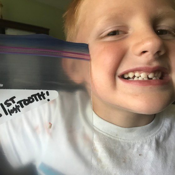 Boy with missing tooth holding Ziploc bag that says “1st lost tooth” (the tooth is in the bag). 